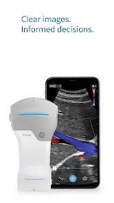 Vscan Air Wireless Ultrasound