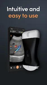 Clarius Ultrasound